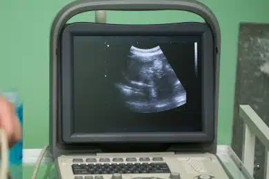 Ultrasound machine displaying a scan during a dog's diagnostic exam